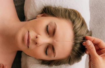 Woman receiving acupuncture treatment on her forehead.
