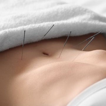 acupuncture needles on a stomach