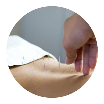 Acupuncture image