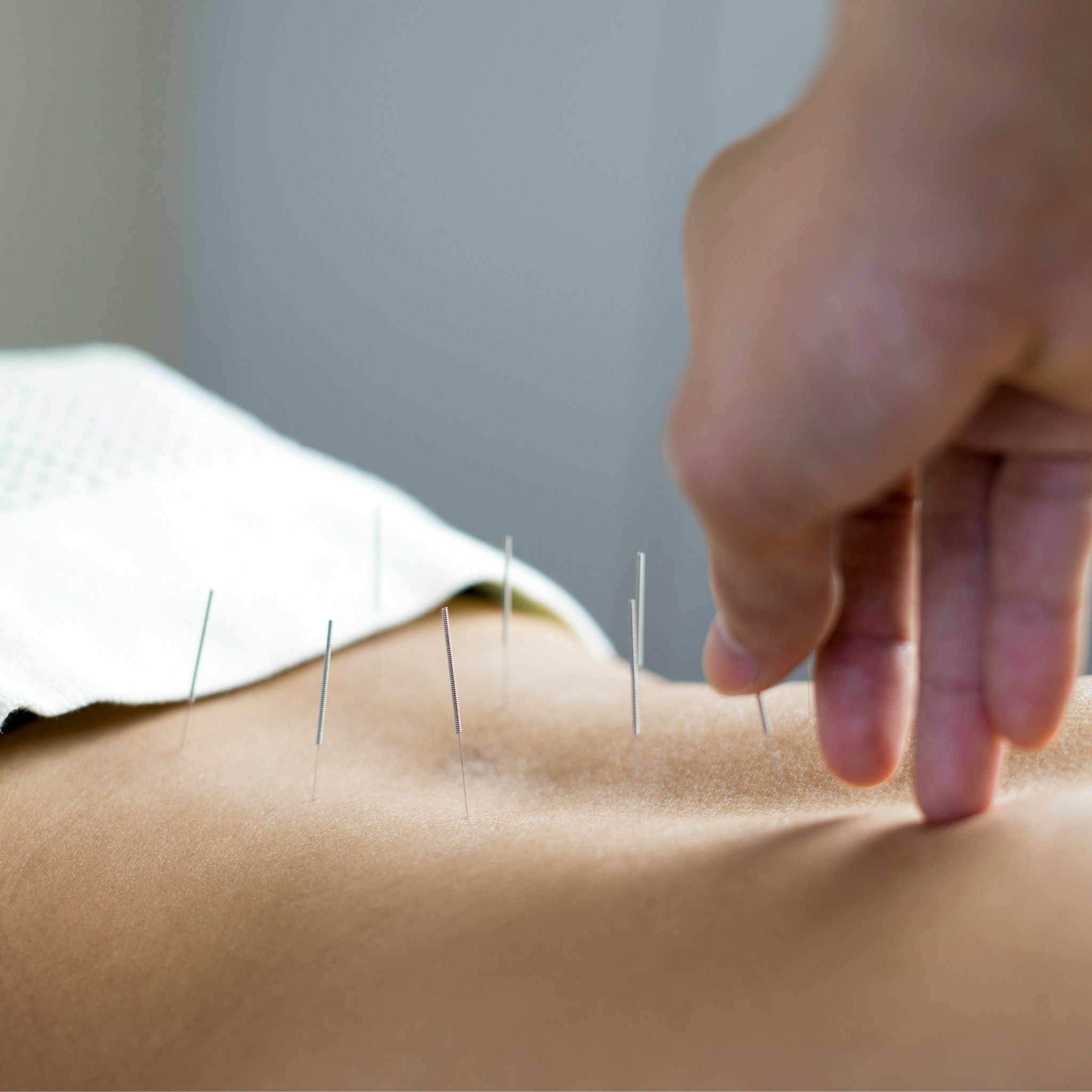 Thrive Urban Wellness Service 60 Minutes Acupuncture